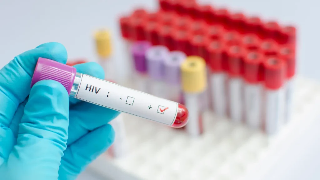 VIH: Información clave según un infectólogo | BS Health Group SAS VIH: Información clave según un infectólogo | BS Health Group
